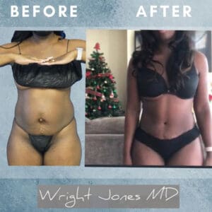 Dr. Jones Before After Photo