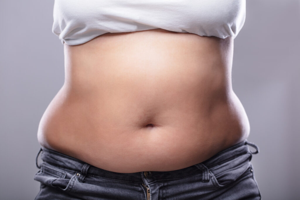 Diastasis Recti Treatment in Atlanta